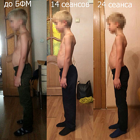 Детская осанка