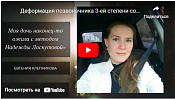 Деформация позвоночника 3-ей степени сократилась с Методом БФМ Надежды Лоскутовой