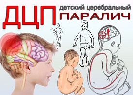 Причины и факторы риска развития ДЦП